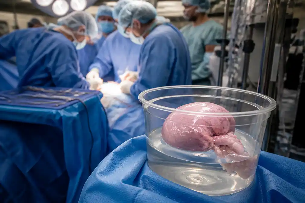 Genetisch aangepaste varkensnier houdt Amerikaanse man recordaantal 271 dagen in leven